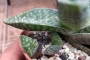 Гастералое (GASTERALOE)